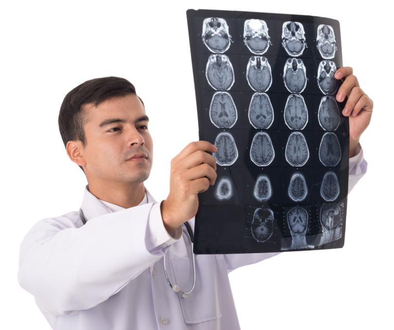 Que son los adenomas hipofisiarios